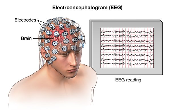 Oblique view of male head showing electrode placement on the scalp for an EEG (Electroencephalogram); SOURCE: Original; M_Brain_skull_EEG.mb