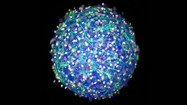 mini-brain_1024