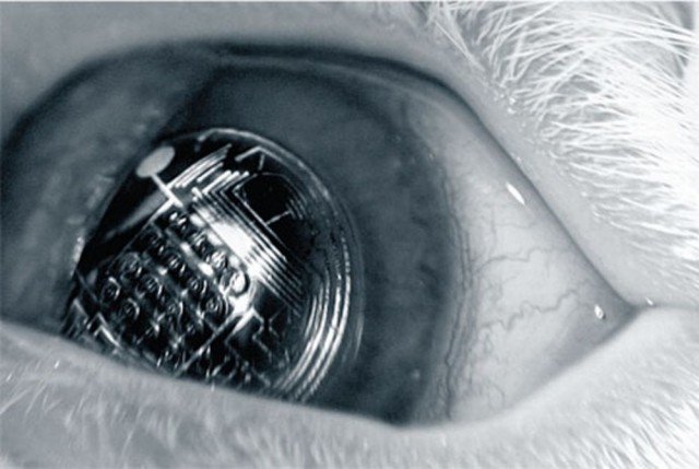 lens1
