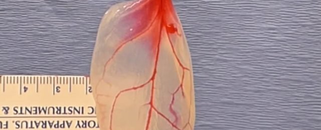 spinach-heart-tissue-image1024