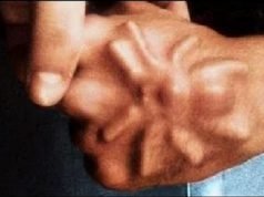 10 ужасни суштества пронајдени во човечко тело