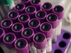 Русија започнува масовно производство на системи за тестирање КОВИД-19